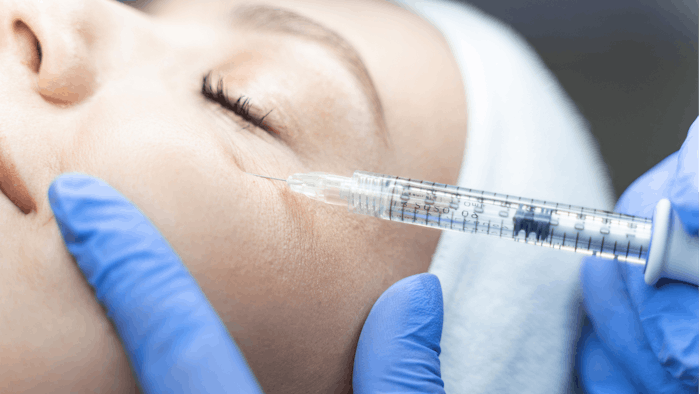Patients with AIIRDs reported high satisfaction with their dermal filler treatments.
