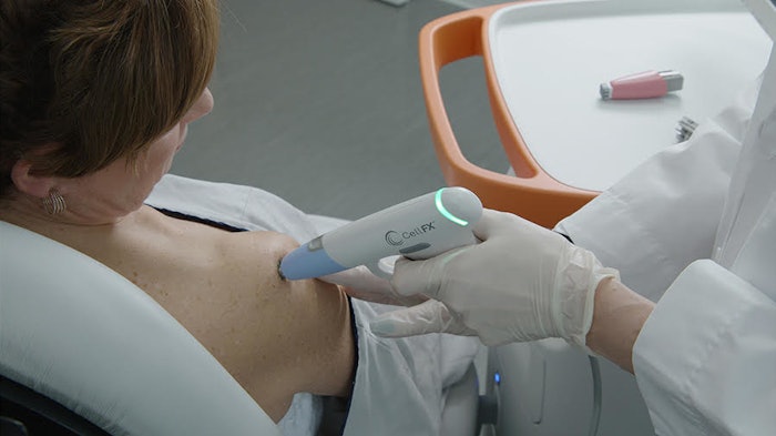 CellFX Treatment