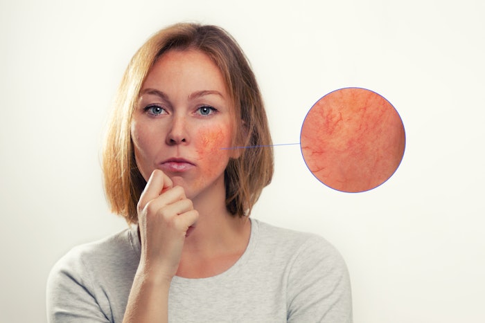 Dreamstime M 163259960