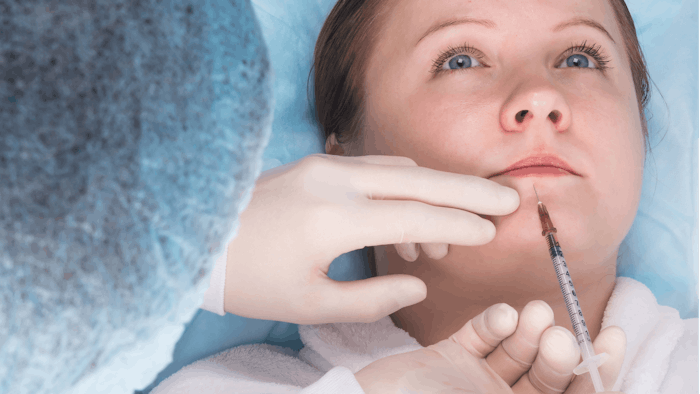 Lip filler
