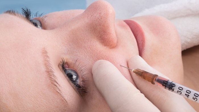 Midface fillers