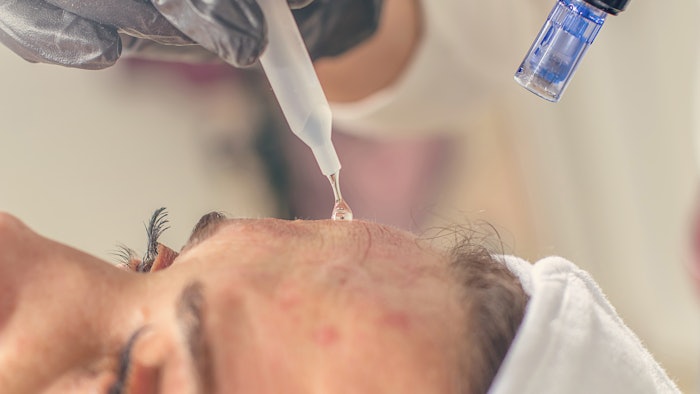 Microneedling with topical