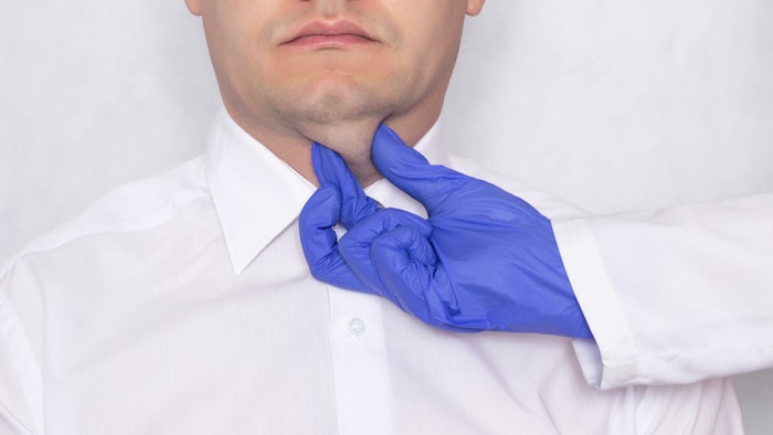 Kybella for double chin