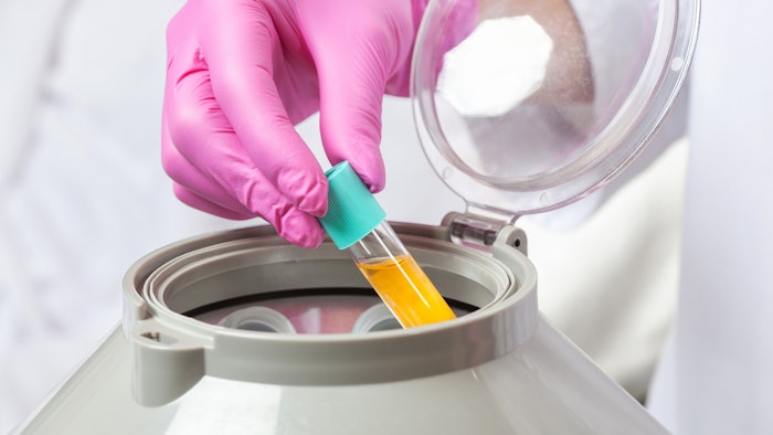 PRP Treatment