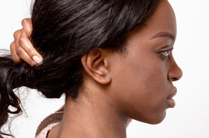 Liposuction followed by subcutaneous RF for neck and chin laxity.