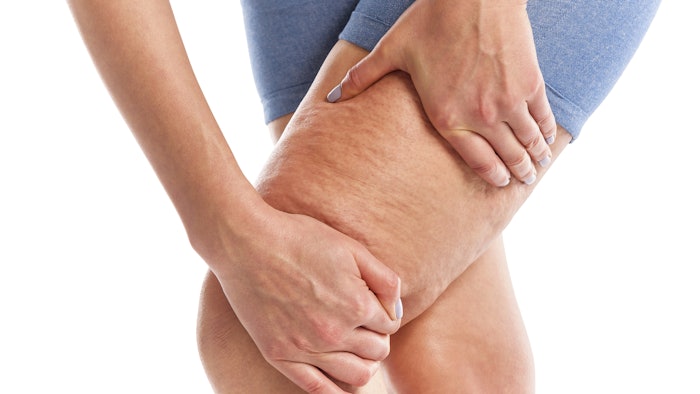 Dreamstime M 109141207