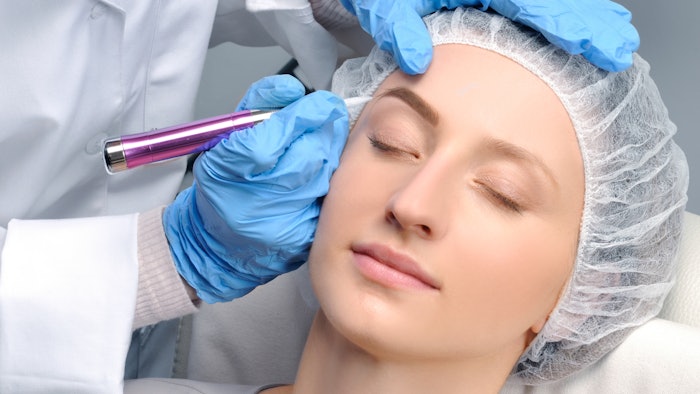 A 28-year-old woman was diagnosed with vitiligo arising from the koebnerisation effect of microblading.