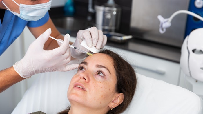 Woman receiving HA fillers