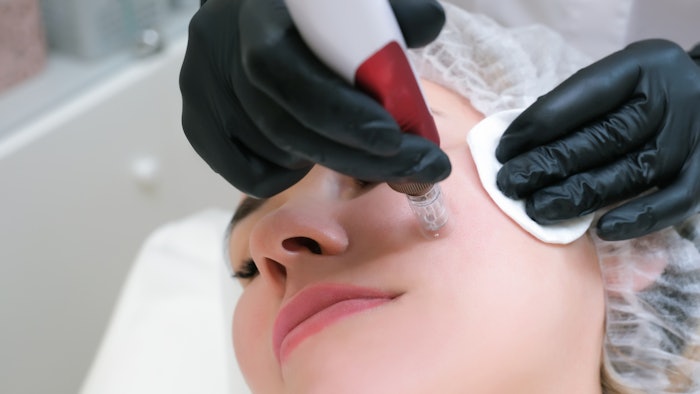 Woman getting microneedling treatment