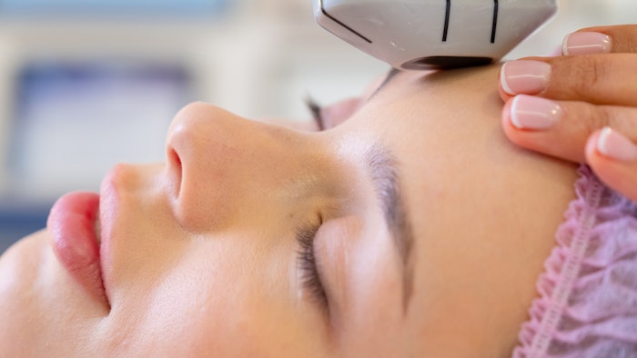 Study shows minimal risk of same day nonablative laser treatment followed by botulinum toxin injections.