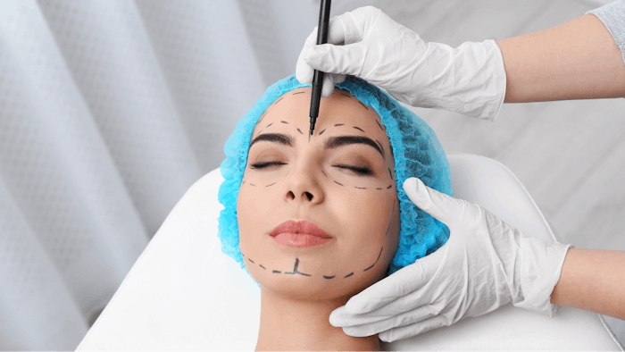 Woman face marked for surgery