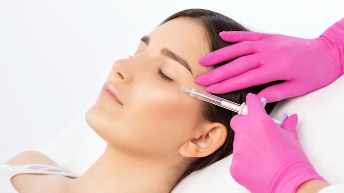 Hyaluronidase effectively resolved late onset edema following supraorbital HA filler injections.