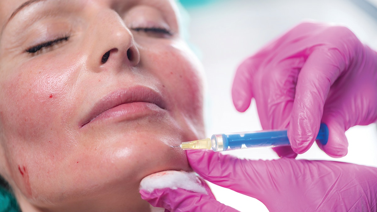 Understanding Filler Rheology for Safer More Attractive Injections ...