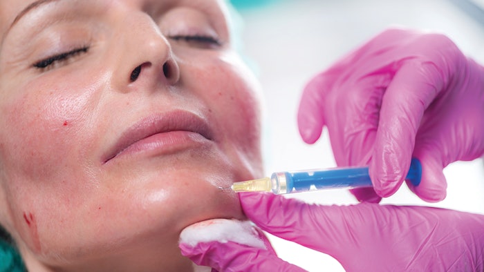 Woman getting filler in her chin