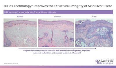 Alastin Me2106 Image2