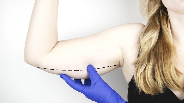 Woman getting upper arm treatment