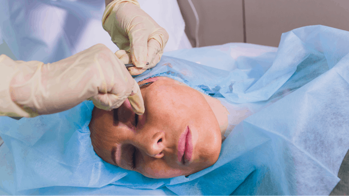 Woman getting thread lifting treatment
