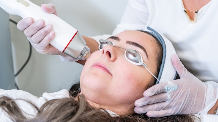 woman getting radiofrequency microneedling