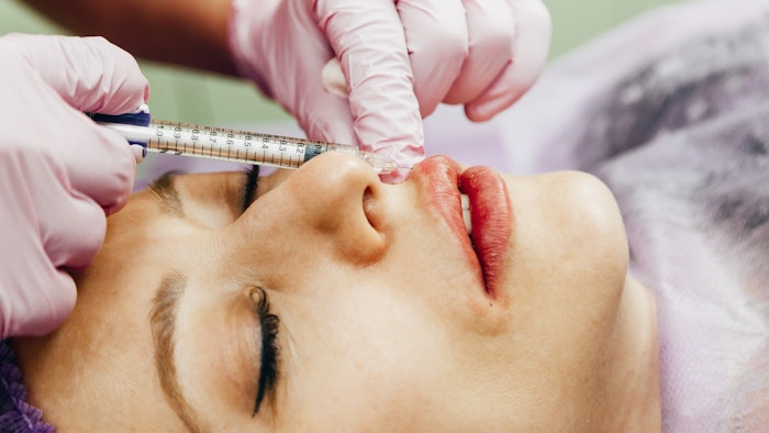 The double-blinded study showed increased longevity with Restylane Slik for perioral lines.