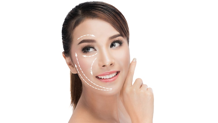 Woman getting face lift