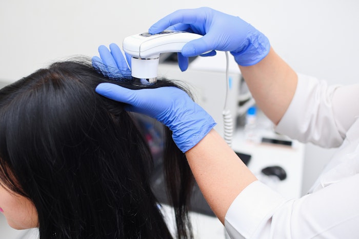 woman getting scalp treatment
