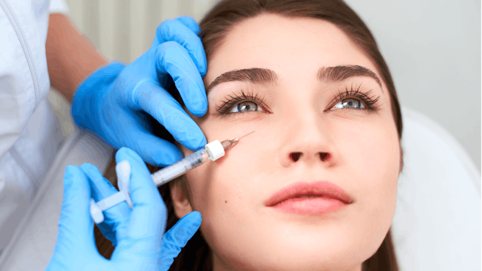 Subjects had increased undereye volume one year after treatment with Juvederm Volbella.