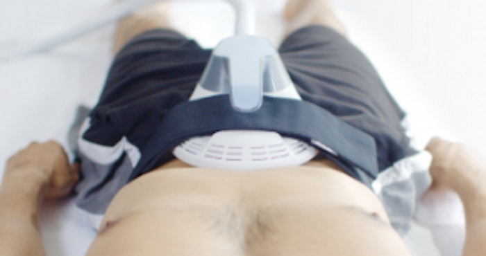The combination RF and HIFEM device damaged fat cells.