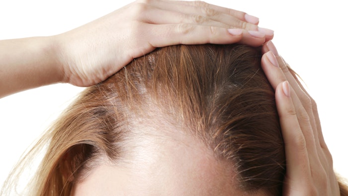 Pumpkin Seed Oil Improves Hair Growth in Female Pattern Hair Loss Patients  | MedEsthetics