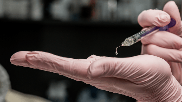 Treating glabellar lines with Dysport at an increased reconstitution and injection volume.