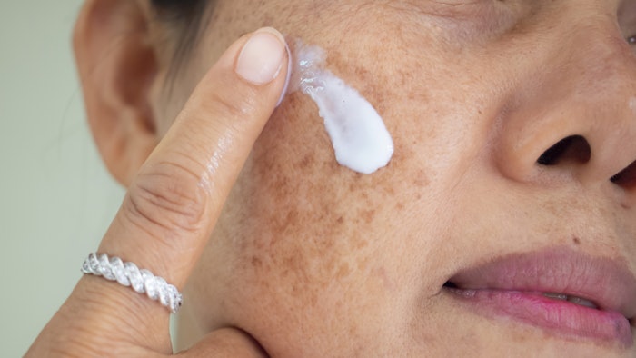 Microneedling-assisted tranexamic acid 4% vs. topical hydroquinone 4% for melasma.