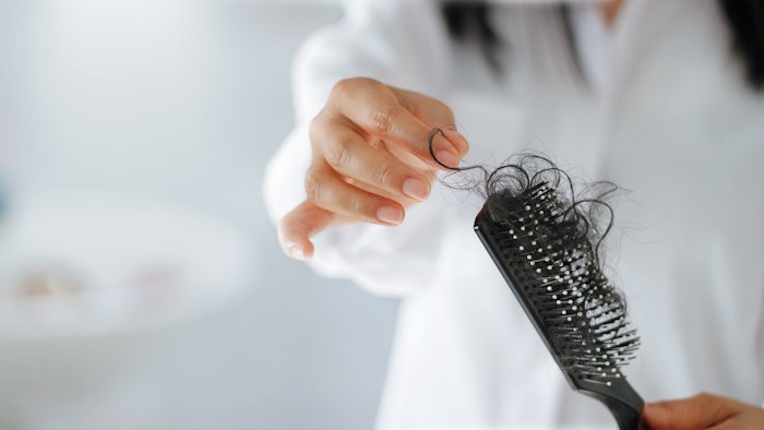 The retrospective study included 3,028 patients with telogen effluvium.