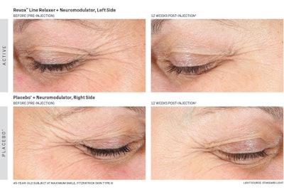 Revision Me2109 Image1