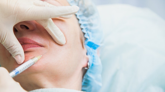 Women getting filler in perioral region