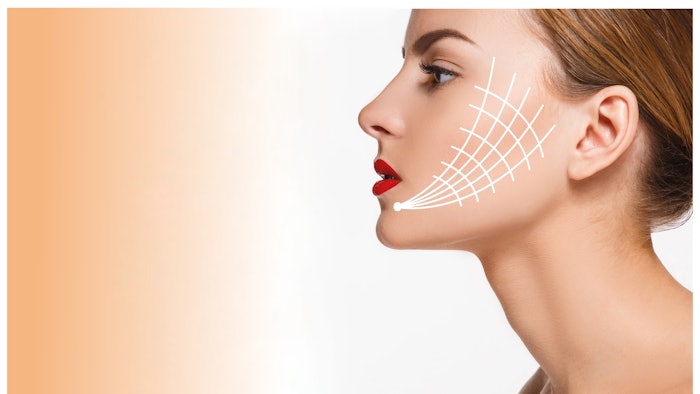 The results of the barbed PDO thread lifts lasted more than 24 weeks.