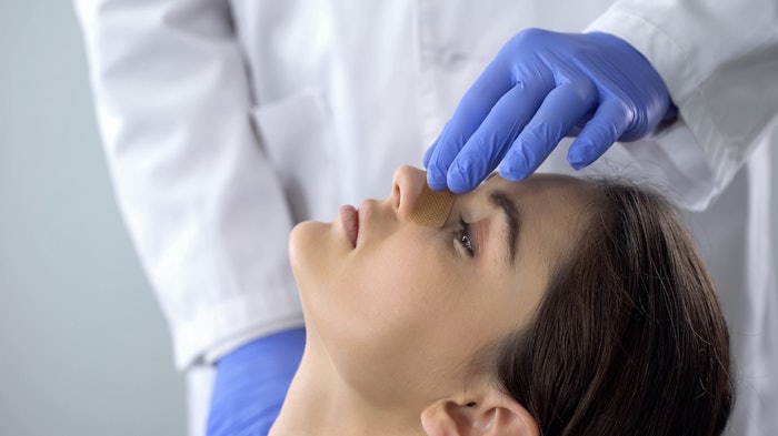 Nd:YAG laser for PMMA-induced granulomas following nonsurgical rhinoplasty.