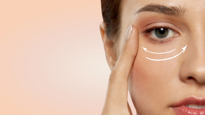 The researchers assessed the effects of soft tissue filler placed directly inferior to the orbicularis retaining ligament.