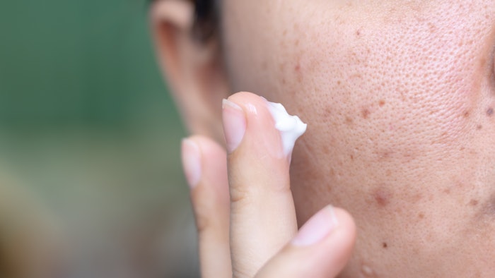 Mean percent improvement in skin clarity from baseline was 43% at week four, 48% at week eight and 50% at week 12.