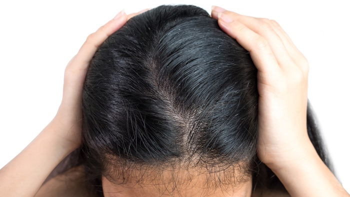 The literature review confirmed that scalp health does directly impact hair growth and appearance.