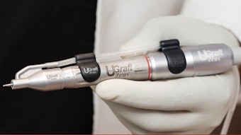 The Dr.UGraft Zeus follicular unit extraction device.