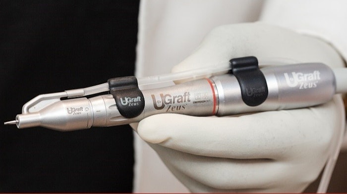 The Dr.UGraft Zeus follicular unit extraction device.
