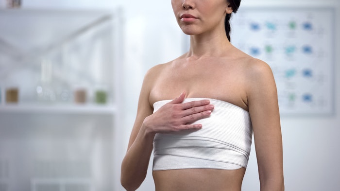 Woman who got breast augmentation