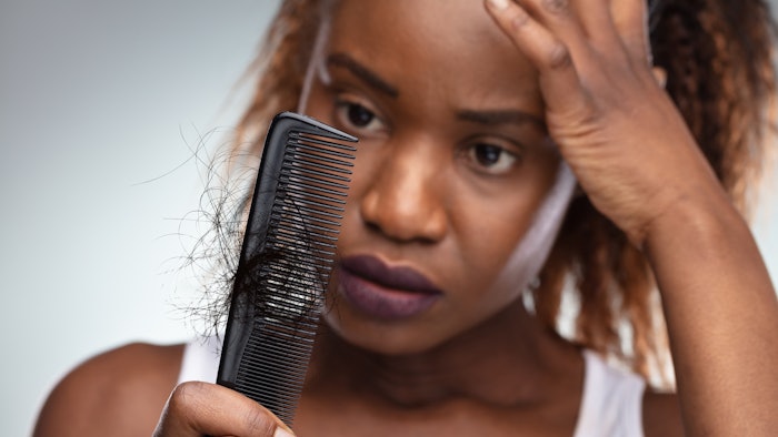 Nutrafol supplements improved hair health of African American, Asian, Hispanic Caucasian and Non-Hispanic Caucasian participants.