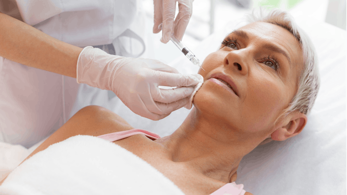 Smaller particle HA filler (Restylane) showed greater longevity compared to a larger particle HA filler.