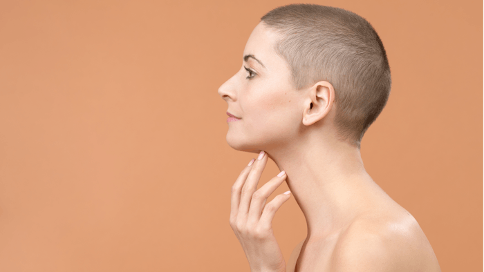 Radiesse (+) Lidocaine has been approved and is now commercially available for improvement of jawline contour.