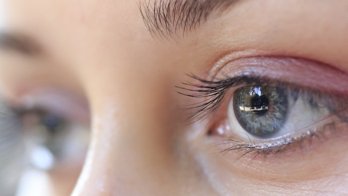 Filler-related ophthalmic artery occlusion and retinal artery occlusion resulted in long-term poor visual outcome and irreversible visual impairment.