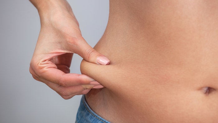 Woman pinching stomach fat