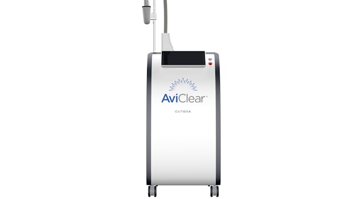The AviClear Acne laser from Cutera selectively targets the sebocytes to suppress sebum production