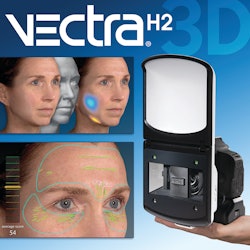 Vectra H2 L