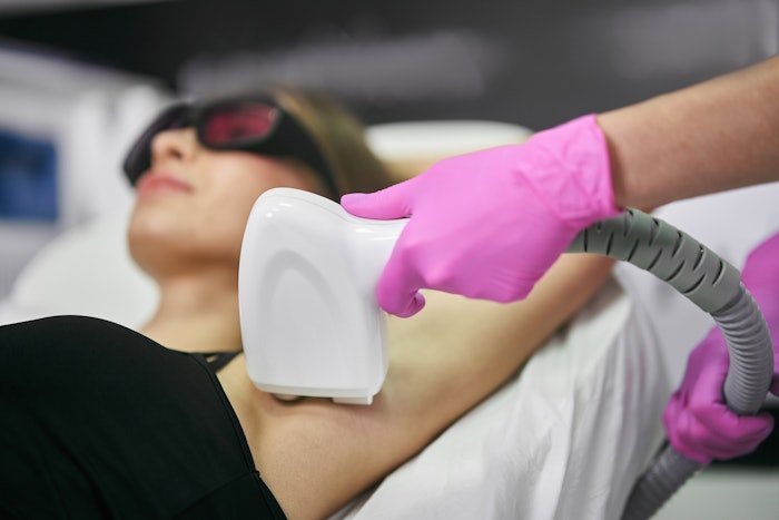 Woman during laser hair removal session