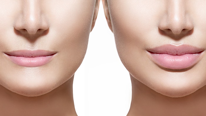 The TLFS helps providers calssify lip fullness to guide treatment and track outcomes.